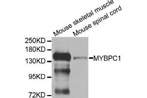 Western blot analysis of extracts of mouse skeletal muscle and mouse spinal cord cell lines, using MYBPC1 antibody. (MYBPC1 antibody)