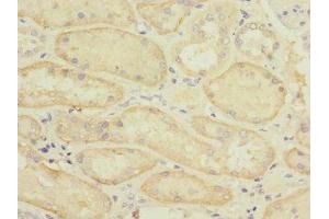 Immunohistochemistry of paraffin-embedded human kidney tissue using ABIN7170165 at dilution of 1:100 (SLC22A8 antibody  (AA 473-542))