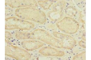 Immunohistochemistry of paraffin-embedded human kidney tissue using ABIN7170165 at dilution of 1:100