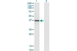 Western Blot analysis of MOAP1 expression in transfected 293T cell line by MOAP1 monoclonal antibody (M02), clone 4A1.