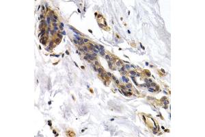 Immunohistochemistry of paraffin-embedded human normal breast using PKLR antibody (ABIN5970989) at dilution of 1/200 (40x lens). (PKLR antibody)