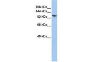 Image no. 1 for anti-Ring Finger Protein 20 (RNF20) (AA 108-157) antibody (ABIN6740810) (RNF20 antibody  (AA 108-157))