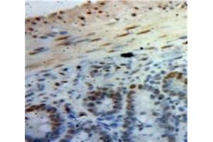Used in DAB staining on fromalin fixed paraffin-embedded Bowels tissue (HMGA1 antibody  (AA 3-107))