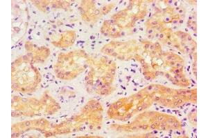 Immunohistochemistry of paraffin-embedded human kidney tissue using ABIN7143174 at dilution of 1:100 (ACVR1 antibody  (AA 20-125))
