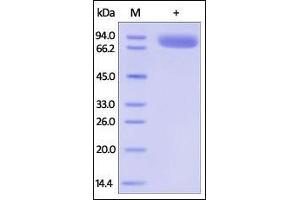 Human IL-1 RII, Fc Tag on SDS-PAGE under reducing (R) condition. (IL1R2 Protein (AA 14-343) (Fc Tag))