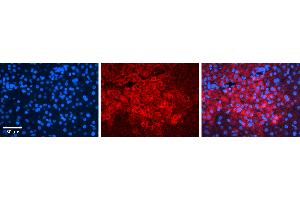 Rabbit Anti-IRF1 Antibody   Formalin Fixed Paraffin Embedded Tissue: Human Liver Tissue Observed Staining: Cytoplasm in hepatocytes Primary Antibody Concentration: 1:100 Other Working Concentrations: 1:600 Secondary Antibody: Donkey anti-Rabbit-Cy3 Secondary Antibody Concentration: 1:200 Magnification: 20X Exposure Time: 0. (IRF1 antibody  (N-Term))