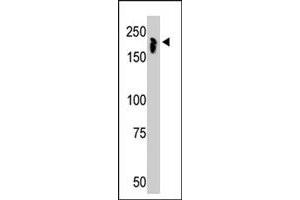 The NCOR1 polyclonal antibody  is used in Western blot to detect NCOR1 in mouse thymus tissue lysate. (NCOR1 antibody  (N-Term))