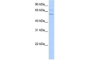 Carboxypeptidase N2 antibody used at 0. (CPN2 antibody  (N-Term))