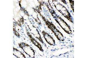 Anti- MCM7 Picoband antibody,IHC(P) IHC(P): Rat Intestine Tissue (MCM7 antibody  (AA 526-719))