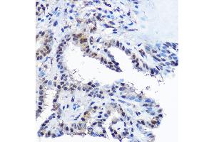 Immunohistochemistry (IHC) image for anti-Casein Kinase 2, beta (CSNK2B) (AA 1-215) antibody (ABIN7266105)