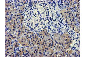 Immunohistochemical staining of paraffin-embedded Human pancreas tissue using anti-LPL mouse monoclonal antibody. (Lipoprotein Lipase antibody  (AA 28-475))
