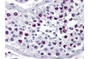 Immunohistochemistry of Rabbit Anti-Cyclin A antibody. (Cyclin A antibody)