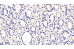 PZP antibody  (AA 1251-1500)