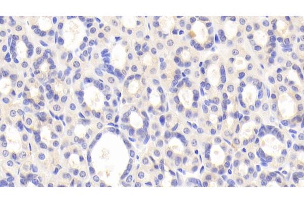 PZP antibody  (AA 1251-1500)