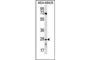 Western blot analysis of OR10AG1 Antibody (C-term) in MDA-MB435 cell line lysates (35ug/lane).