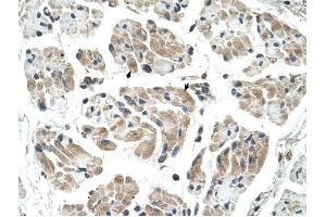 CHST1 antibody was used for immunohistochemistry at a concentration of 4-8 ug/ml to stain Skeletal muscle cells (arrows) in Human Muscle. (CHST1 antibody)