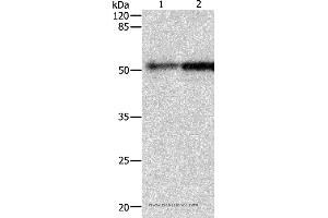 Western blot analysis of Human fetal kidney and lung tissue, using CASP2 Polyclonal Antibody at dilution of 1:950 (Caspase 2 antibody)