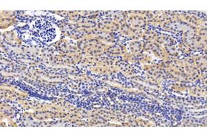Immunohistochemistry (IHC) image for anti-ATG16 Autophagy Related 16-Like 1 (ATG16L1) (AA 342-607) antibody (ABIN7443884)