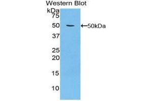 Western Blotting (WB) image for anti-Integrin, alpha 5 (ITGA5) (AA 895-1049) antibody (ABIN1859488) (ITGA5 antibody  (AA 895-1049))