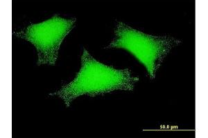 Immunofluorescence of monoclonal antibody to SPEF2 on HeLa cell. (SPEF2 antibody  (AA 324-422))
