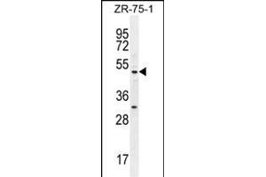 MEF2D Antibody (N-term) (ABIN655656 and ABIN2845129) western blot analysis in ZR-75-1 cell line lysates (35 μg/lane). (MEF2D antibody  (N-Term))