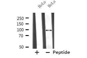 Western blot analysis of extracts from HeLa cells, using MASTL antibody. (MASTL antibody  (C-Term))