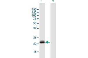 Western Blot analysis of LCN2 expression in transfected 293T cell line by LCN2 MaxPab polyclonal antibody. (Lipocalin 2 antibody  (AA 1-198))