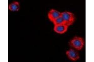 Immunofluorescent analysis of BID staining in RAW264. (BID antibody)