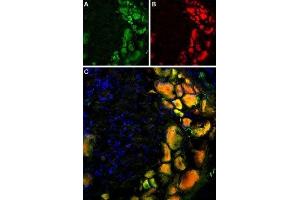 Multiplex staining of TRPV1 and mGluR5 in rat DRG - Immunohistochemical staining of rat dorsal root ganglion using Anti-Rat TRPV1 (VR1) (extracellular)-ATTO Fluor-488 Antibody (ABIN7043839), (1:60) and Anti-mGluR5 (extracellular)-ATTO Fluor-594 Antibody (ABIN7043251), (1:60).
