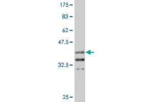 Western Blot detection against Immunogen (37. (Arx antibody  (AA 159-264))