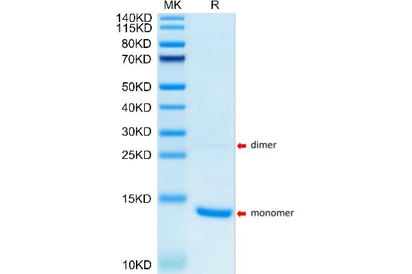 S100A9 Protein (AA 2-114) (His tag)