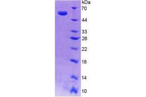 SDS-PAGE analysis of Human SPR Protein. (SPR Protein)
