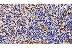 Detection of Bcl2L in Human Appendix Tissue using Monoclonal Antibody to B-Cell CLL/Lymphoma 2 Like Protein (Bcl2L) (BCL2L1 antibody  (AA 2-212))