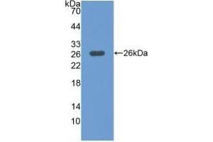 Detection of Recombinant MAP3K1, Human using Polyclonal Antibody to Mitogen Activated Protein Kinase Kinase Kinase 1 (MAP3K1) (MAP3K1 antibody  (AA 1307-1509))