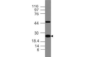 Image no. 1 for anti-Adiponectin (ADIPOQ) (AA 40-230) antibody (ABIN5027479) (ADIPOQ antibody  (AA 40-230))