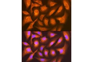 Immunofluorescence analysis of U-2 OS cells using F/UBD Rabbit mAb (ABIN7271134) at dilution of 1:100 (40x lens). (UBD antibody)