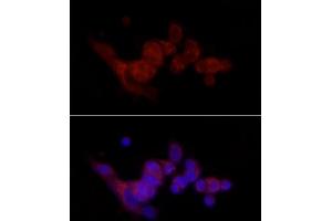 Immunofluorescence analysis of MCF7 cells using SREBF1 Rabbit pAb (ABIN7270598) at dilution of 1:100 (40x lens). (SREBF1 antibody  (AA 1-100))