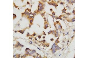 Anti-Cystathionase antibody, IHC(P) IHC(P): Human Liver Tissue (CTH antibody  (C-Term))