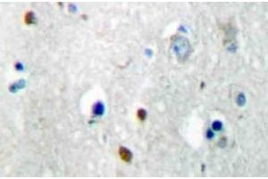Immunohistochemistry (IHC) analyzes of MKP-2 antibody in paraffin-embedded human brain tissue. (DUSP4 antibody)