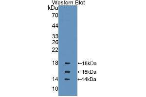 Detection of Recombinant IL15, Rat using Polyclonal Antibody to Interleukin 15 (IL15) (IL-15 antibody  (AA 49-162))