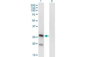 Western Blot analysis of KLRA1 expression in transfected 293T cell line by KLRA1 monoclonal antibody (M01), clone 1H3. (KLRA1 antibody  (AA 66-171))