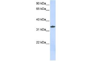 WB Suggested Anti-MRPL15 Antibody Titration:  0. (MRPL15 antibody  (C-Term))