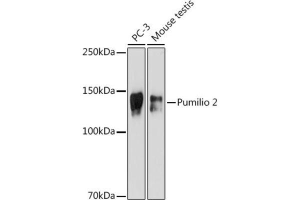 PUM2 抗体