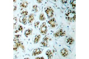 Immunohistochemistry (IHC) image for anti-Nuclear Factor-kB p65 (NFkBP65) (pSer311) antibody (ABIN1870583) (NF-kB p65 antibody  (pSer311))