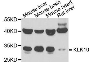 Western blot analysis of extracts of various cells, using KLK10 antibody. (Kallikrein 10 antibody)