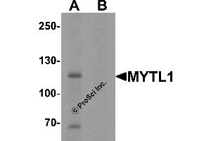 Western Blotting (WB) image for anti-Myelin Transcription Factor 1-Like (MYT1L) (C-Term) antibody (ABIN1077393)