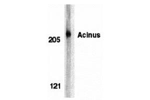 Western blot analysis of acinus in K562 whole cell lysate with acinus antibody at 1 µg/mL.