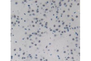 #VALUE! (NUP214 antibody  (AA 601-868))