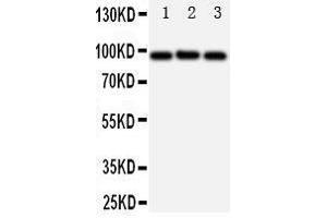 Western Blotting (WB) image for anti-ATP-Binding Cassette, Sub-Family B (MDR/TAP), Member 6 (ABCB6) (AA 818-842), (C-Term) antibody (ABIN3044283) (ABCB6 antibody  (C-Term))