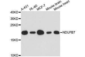 Western blot analysis of extracts of various cell lines, using NDUFB7 antibody.